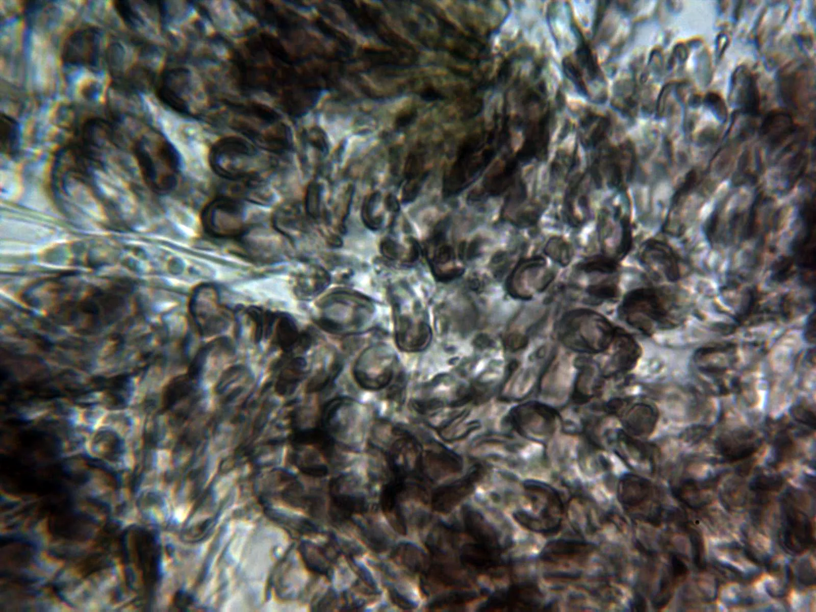 Microscopía de Patellariopsis atrovinosa - 10 - X 1000 agua